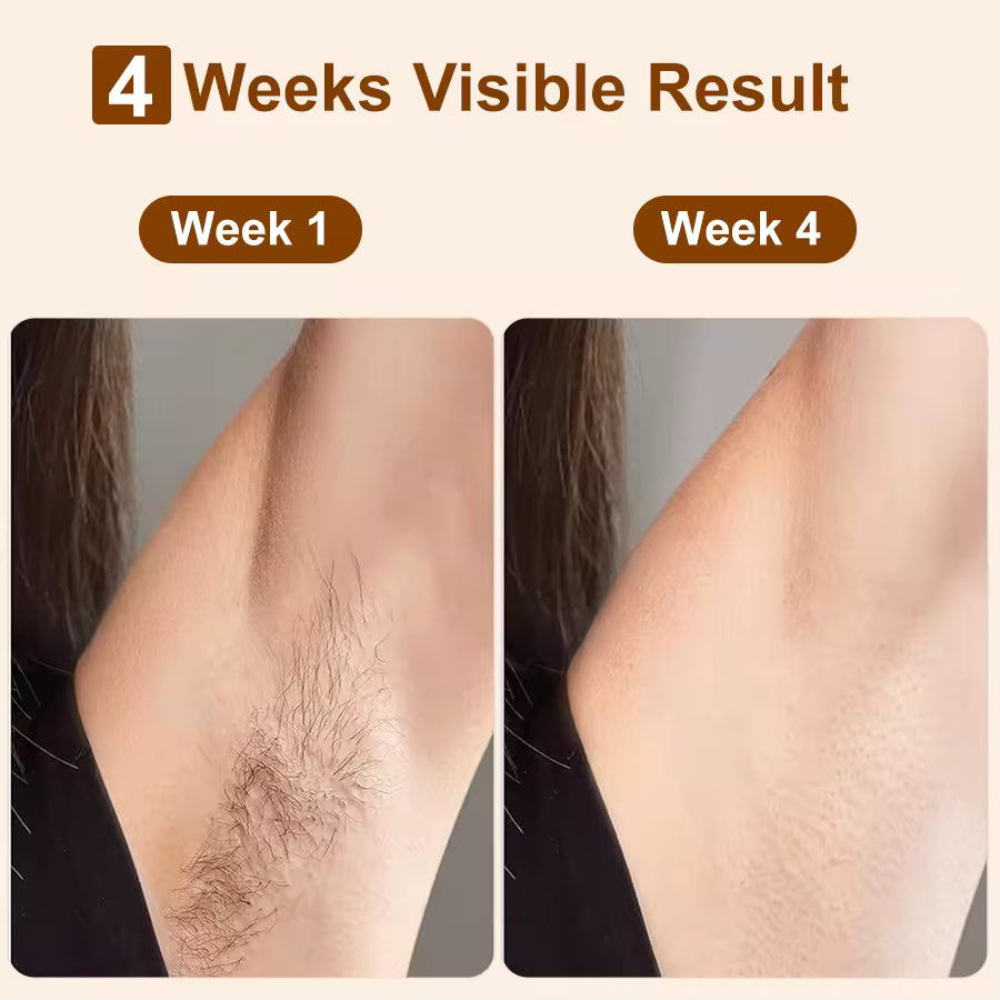 Depiladora Láser IPL de Doble Tubo Profesional y Portátil